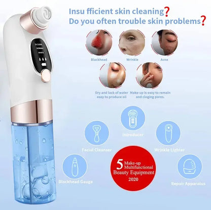 Blackhead Remover-أداة شفط لتنظيف المسام