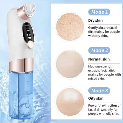 Blackhead Remover-أداة شفط لتنظيف المسام
